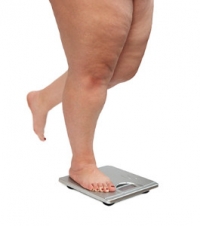 The Effects Obesity Has On the Feet